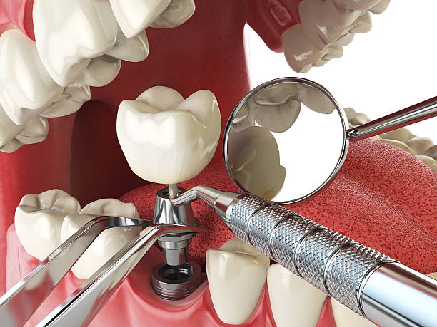 Best Walk-In Emergency Dental Services in Donaldsonville, LA
